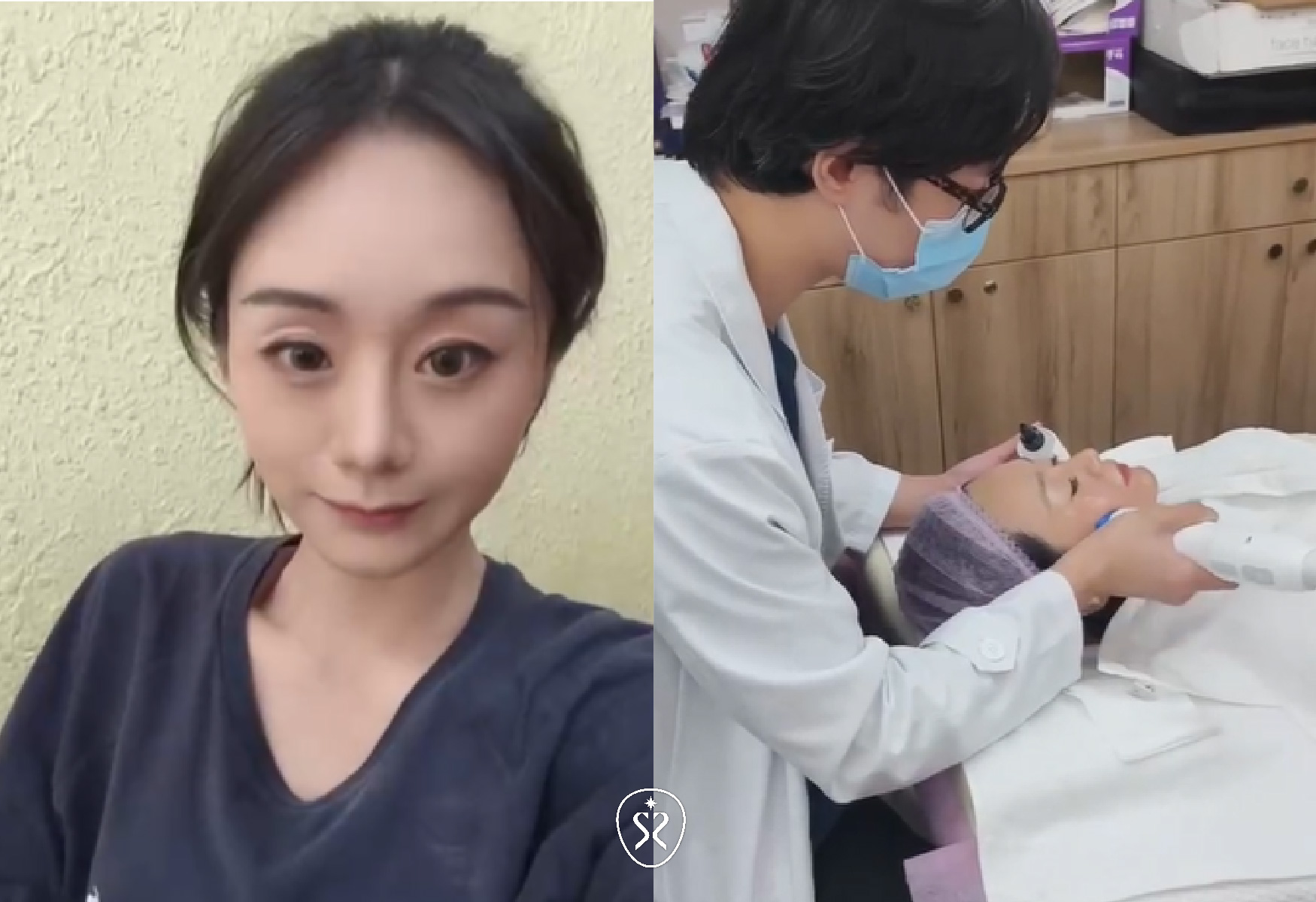 十蓓電波利用單極電波能量，容積式大面積加熱，將能量深入真皮層，刺激膠原蛋白增生，幫助皮膚恢復及維持緊實